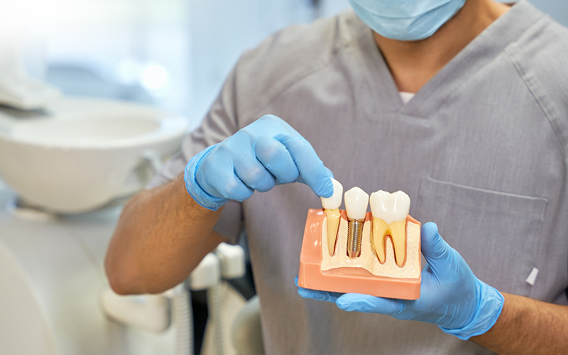 Dental Implant Specialist performing procedure at Fusion Implant Dentistry